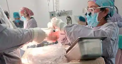 Hepático de