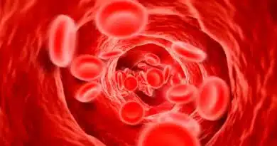 presión arterial hipertensión