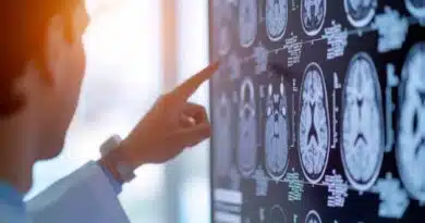 En ocho años aumentó un 50% la cantidad de microplásticos hallados en cerebros humanos microplásticos