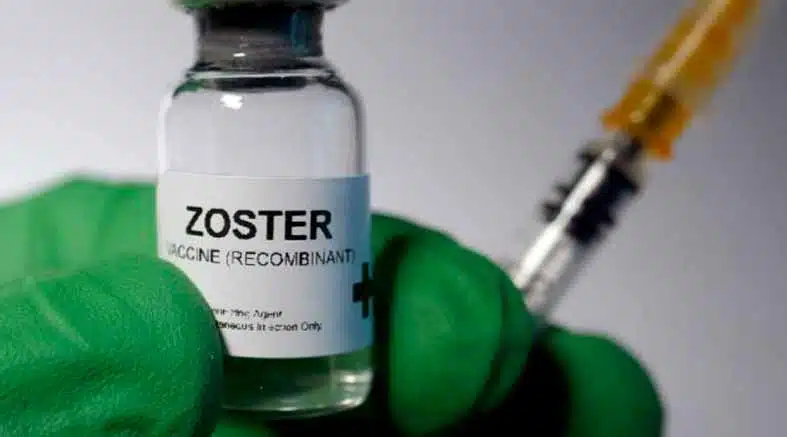 zóster