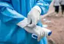 Detectan